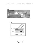 Bin1 as a Prognostic Marker in Cardiovascular Disease diagram and image