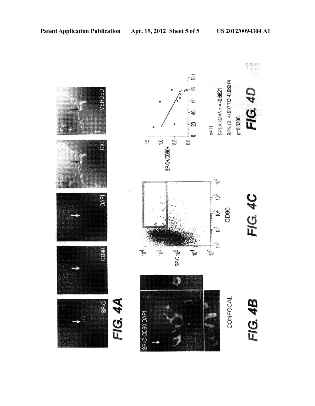 METHOD OF PREPARING HUMAN LUNG TISSUE STEM CELLS AND METHOD OF INDUCING     DIFFERENTIATION INTO HUMAN ALVEOLAR EPITHELIAL CELLS - diagram, schematic, and image 06