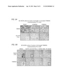 DETECTING AND TREATING BREAST CANCER RESISTANCE TO EGFR INHIBITORS diagram and image