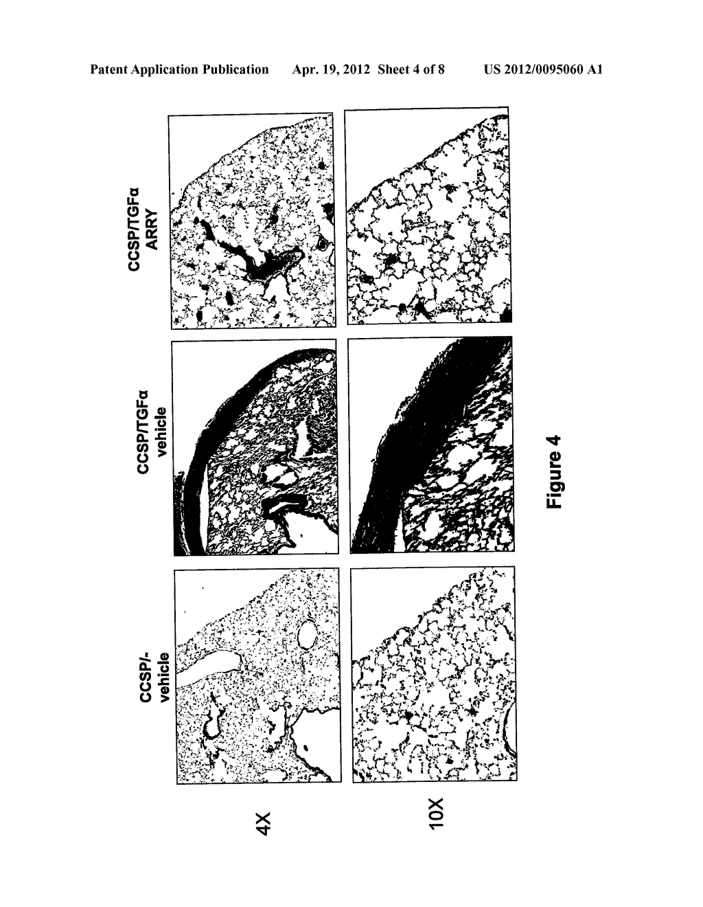 METHODS AND COMPOSITIONS OF MITOGEN-ACTIVATED PROTEIN KINASE (MAPK)     PATHWAY INHIBITORS FOR TREATING PULMONARY FIBROSIS - diagram, schematic, and image 05