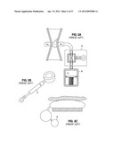 SELF-ADJUSTING GASTRIC BAND diagram and image