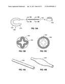 SELF-ADJUSTING GASTRIC BAND diagram and image