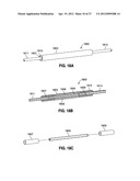 SELF-ADJUSTING GASTRIC BAND diagram and image