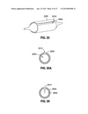 SELF-ADJUSTING GASTRIC BAND diagram and image