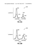 SELF-ADJUSTING GASTRIC BAND diagram and image