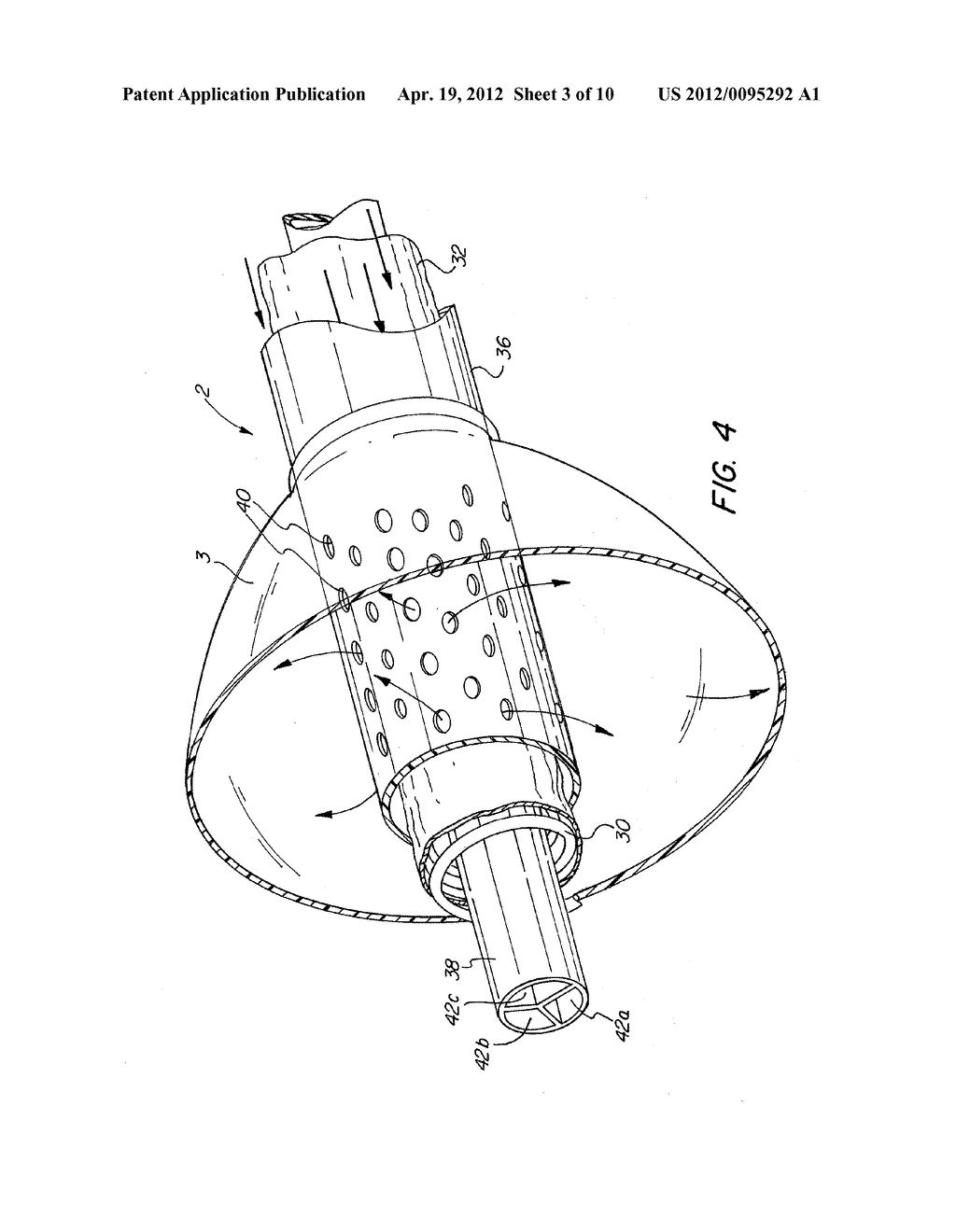 Anchored Guidewire - diagram, schematic, and image 04