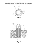 Expandable Spinal Access Instruments and Methods of Use diagram and image