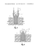 Expandable Spinal Access Instruments and Methods of Use diagram and image