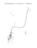 Guidewire-Assisted Catheter Placement System diagram and image