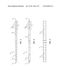 Guidewire-Assisted Catheter Placement System diagram and image