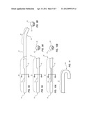 Guidewire-Assisted Catheter Placement System diagram and image