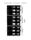 TREATMENT OF BRAIN DISEASES VIA ULTRASOUND/MAGNETIC TARGETING DELIVERY AND     TRACING OF THERAPEUTIC AGENTS diagram and image