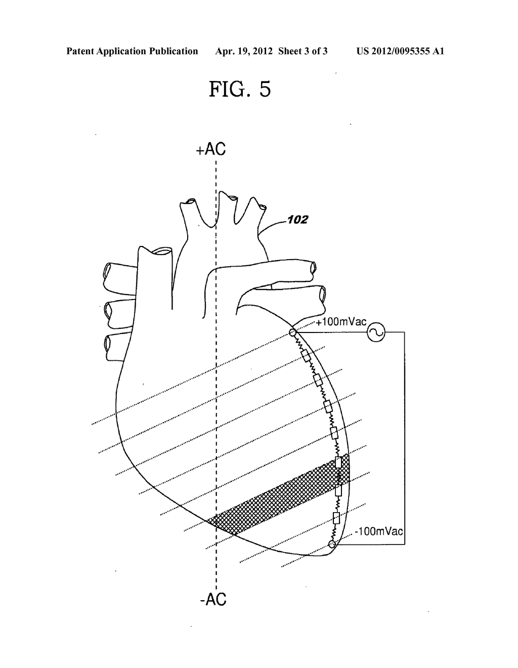 Volume Sensing - diagram, schematic, and image 04