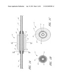 ULTRASOUND CATHETER FOR PROVIDING A THERAPEUTIC EFFECT TO A VESSEL OF A     BODY diagram and image