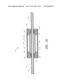 ULTRASOUND CATHETER FOR PROVIDING A THERAPEUTIC EFFECT TO A VESSEL OF A     BODY diagram and image