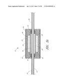 ULTRASOUND CATHETER FOR PROVIDING A THERAPEUTIC EFFECT TO A VESSEL OF A     BODY diagram and image