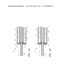 ULTRASOUND CATHETER FOR PROVIDING A THERAPEUTIC EFFECT TO A VESSEL OF A     BODY diagram and image