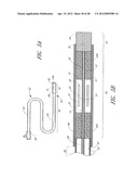 ULTRASOUND CATHETER FOR PROVIDING A THERAPEUTIC EFFECT TO A VESSEL OF A     BODY diagram and image