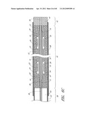 ULTRASOUND CATHETER FOR PROVIDING A THERAPEUTIC EFFECT TO A VESSEL OF A     BODY diagram and image