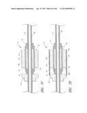 ULTRASOUND CATHETER FOR PROVIDING A THERAPEUTIC EFFECT TO A VESSEL OF A     BODY diagram and image