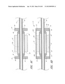 ULTRASOUND CATHETER FOR PROVIDING A THERAPEUTIC EFFECT TO A VESSEL OF A     BODY diagram and image