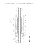 ULTRASOUND CATHETER FOR PROVIDING A THERAPEUTIC EFFECT TO A VESSEL OF A     BODY diagram and image