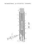 ULTRASOUND CATHETER FOR PROVIDING A THERAPEUTIC EFFECT TO A VESSEL OF A     BODY diagram and image