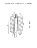 ULTRASOUND CATHETER FOR PROVIDING A THERAPEUTIC EFFECT TO A VESSEL OF A     BODY diagram and image