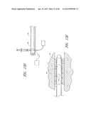 ULTRASOUND CATHETER FOR PROVIDING A THERAPEUTIC EFFECT TO A VESSEL OF A     BODY diagram and image