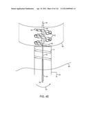 SYSTEM FOR PROVIDING SURGICAL ACCESS diagram and image