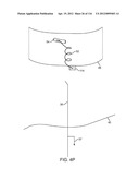 SYSTEM FOR PROVIDING SURGICAL ACCESS diagram and image