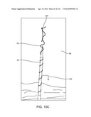 SYSTEM FOR PROVIDING SURGICAL ACCESS diagram and image