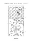 SYSTEM FOR PROVIDING SURGICAL ACCESS diagram and image