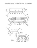 Method and Apparatus for Coupling Soft Tissue to a Bone diagram and image