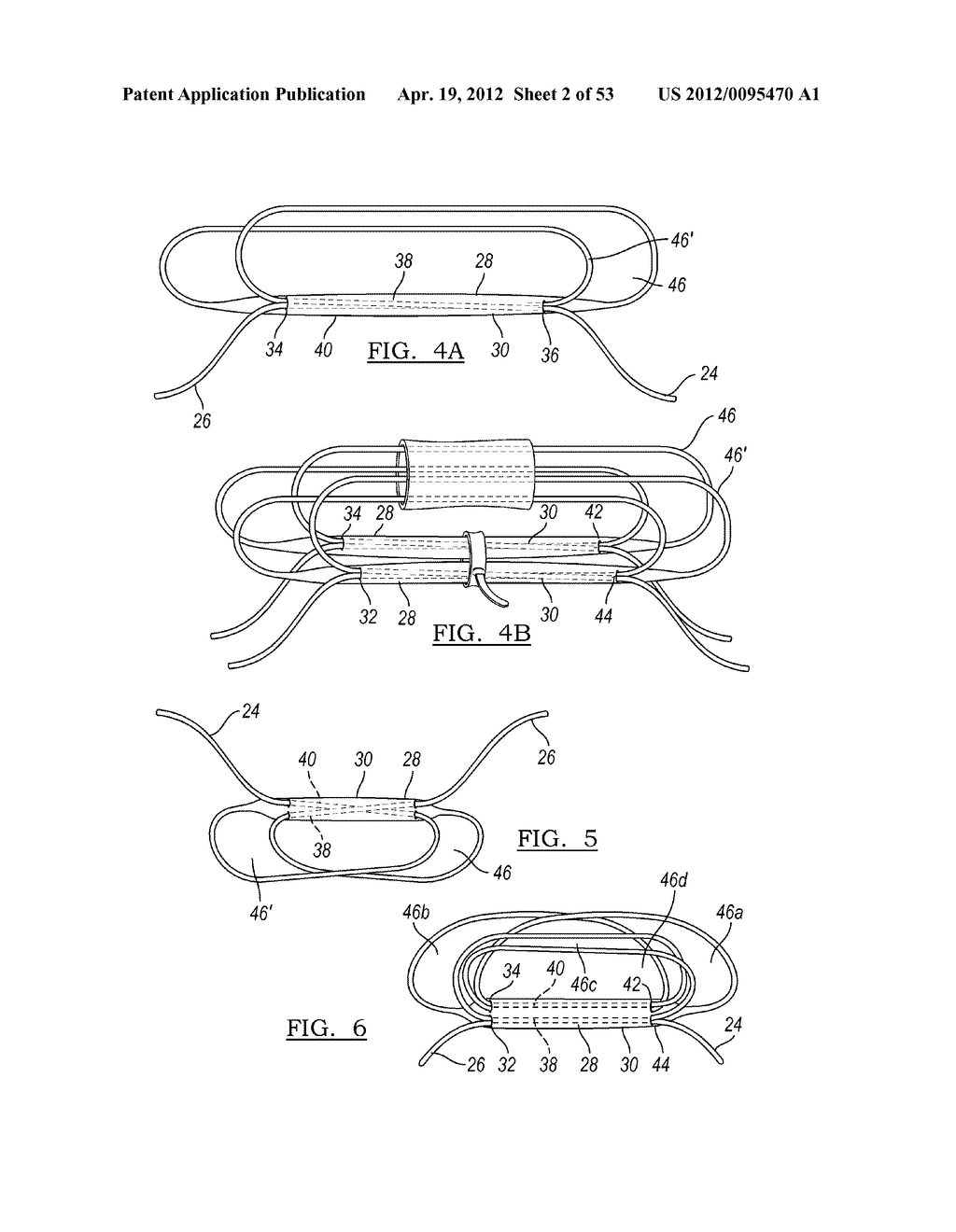 Method and Apparatus for Coupling Soft Tissue to a Bone - diagram, schematic, and image 03