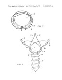 Method and Apparatus for Coupling Soft Tissue to a Bone diagram and image