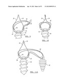 Method and Apparatus for Coupling Soft Tissue to a Bone diagram and image