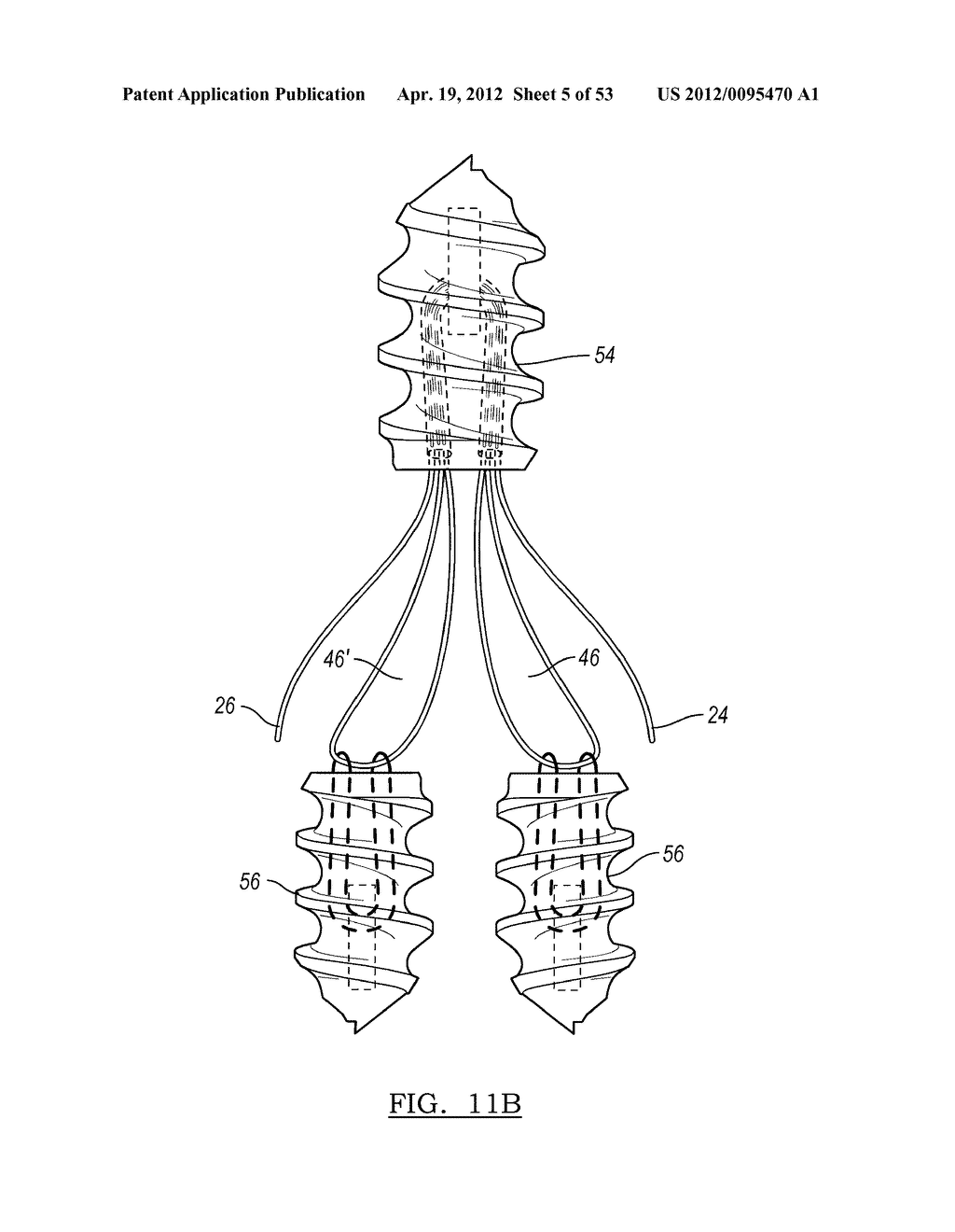 Method and Apparatus for Coupling Soft Tissue to a Bone - diagram, schematic, and image 06