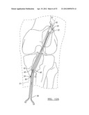 Method and Apparatus for Coupling Soft Tissue to a Bone diagram and image