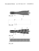 Method and Apparatus for Coupling Soft Tissue to a Bone diagram and image