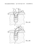 Method and Apparatus for Coupling Soft Tissue to a Bone diagram and image