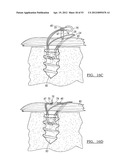 Method and Apparatus for Coupling Soft Tissue to a Bone diagram and image