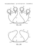 Method and Apparatus for Coupling Soft Tissue to a Bone diagram and image