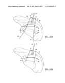 Method and Apparatus for Coupling Soft Tissue to a Bone diagram and image