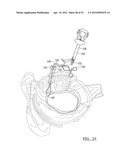 Method and Apparatus for Coupling Soft Tissue to a Bone diagram and image