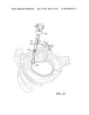 Method and Apparatus for Coupling Soft Tissue to a Bone diagram and image