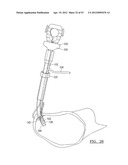 Method and Apparatus for Coupling Soft Tissue to a Bone diagram and image