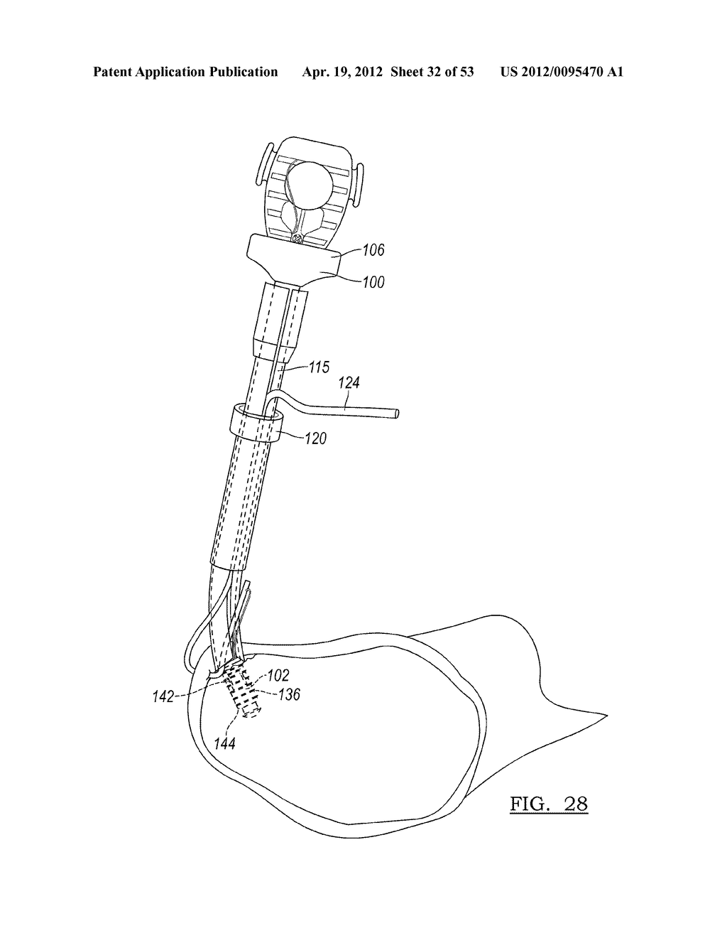 Method and Apparatus for Coupling Soft Tissue to a Bone - diagram, schematic, and image 33