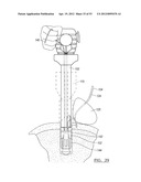 Method and Apparatus for Coupling Soft Tissue to a Bone diagram and image