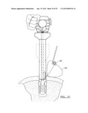 Method and Apparatus for Coupling Soft Tissue to a Bone diagram and image